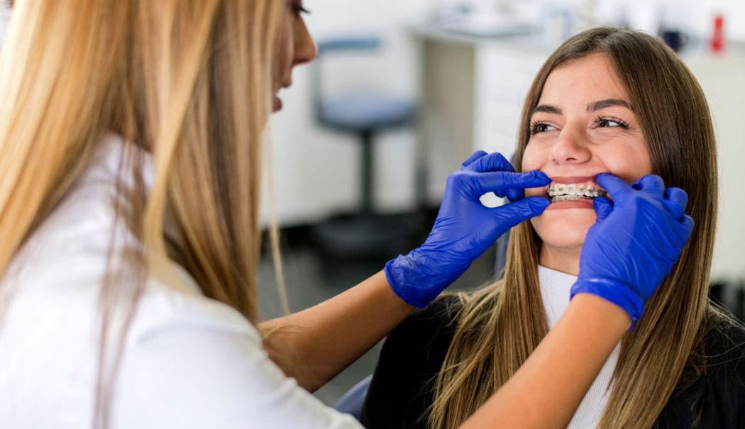 Sfaturi pentru ameliorarea disconfortului dat de purtarea unui aparat dentar - aparat-1728814810.jpg