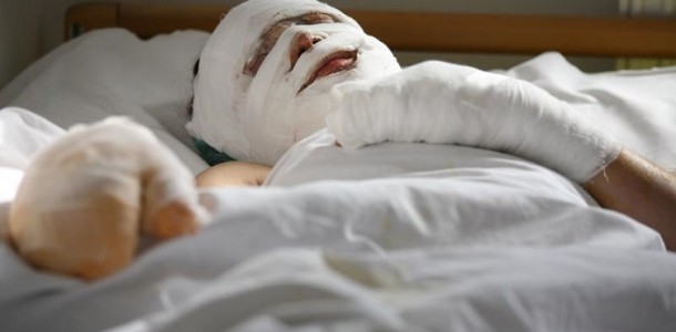 Unul din oamenii străzii incendiați la Galați a murit - ars-1477749001.jpg