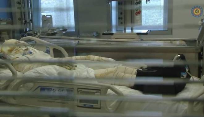 Atenție! Imagini video care vă pot afecta emoțional! Cum sunt tratați pacienții arși la Colectiv, în spitalele din străinătate - ars0367dbc4d8a8-1447748373.jpg