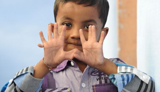 Un băiat din India are 25 de degete / Galerie foto - article222515015c1cdde000005dc50-1351617668.jpg