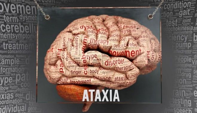 Ce este ataxia și cum influențează echilibrul? - ataxie-1684498173.jpg