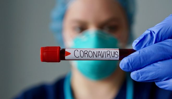 Încă 10 persoane infectate cu noul coronavirus au murit. Bilanțul GCS ajunge la 1.589 - b69ac57c4b0443118a49a3e3e23681cd-1593264047.jpg