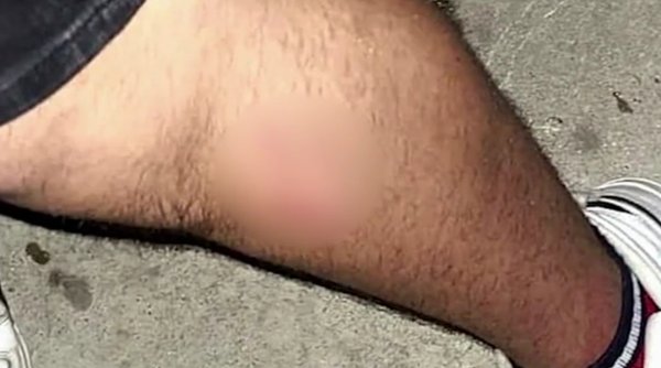 "Este şocat, nu mai doarme de durere" Un adolescent a fost snopit în bătaie de un bărbat, în faţa unui liceu din Constanţa