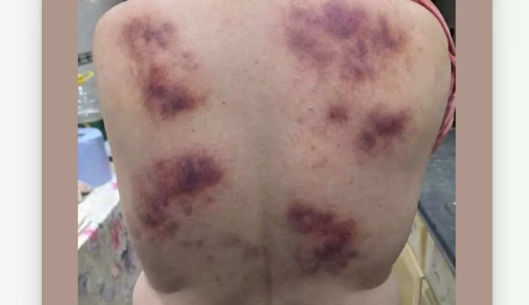 Curaj pedepsit cu pumnii. A sărit în ajutor și a fost lovită crunt - bataie-agresor-1771840055.webp