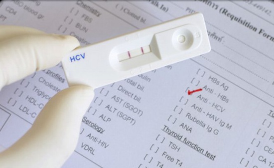 Ce trebuie să știe pacienții care încep tratamentul împotriva Hepatitei C - baylor-1476097821.jpg