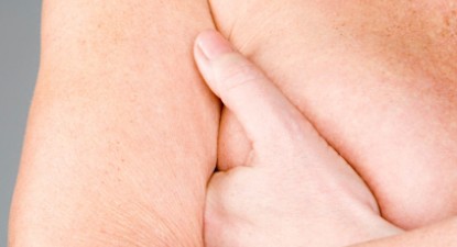 Terapie pentru cancerul la sân ce exclude mastectomia - bb5c3a7f993b7cb25b2410e212e0386a.jpg