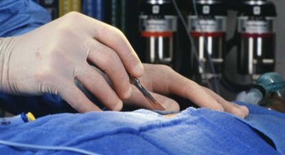 Pacient operat pe cord deschis de chirurgii germani, menținut în viață de aparate - bc75ff7fa7c93911d66636932445c82f.jpg