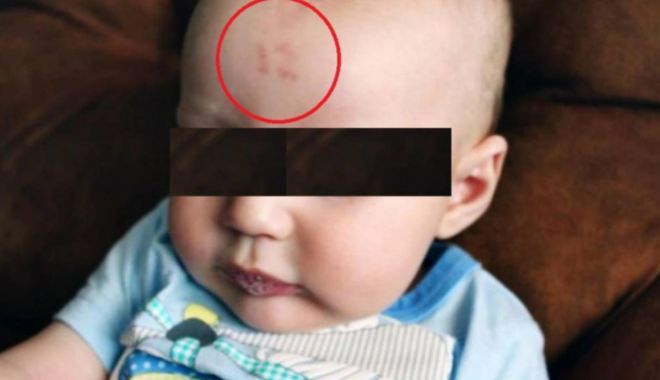 Medicii, uimiţi de semnul care i-a apărut unui bebeluş pe frunte, după naştere - bebe-1672499418.jpg