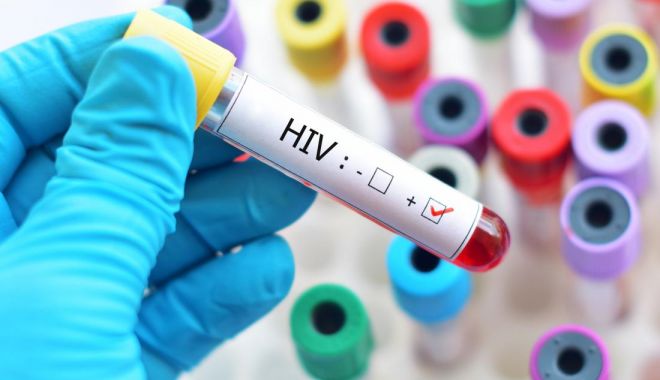 Al doilea caz din lume de remisiune la un pacient cu HIV - bloodsampleintesttube-1551774529.jpg