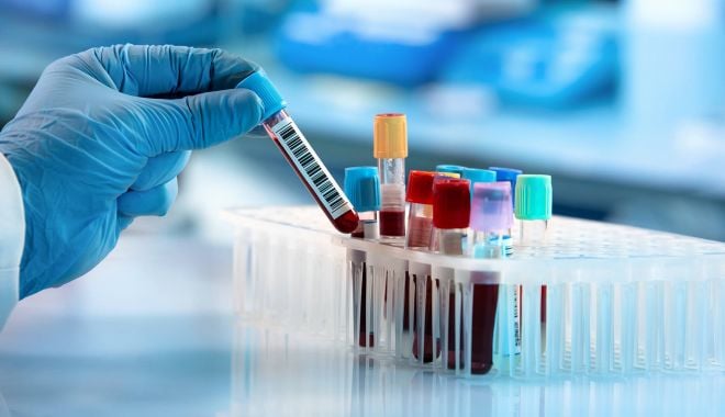Persoanele care infectează pe cineva cu Covid-19 ar putea fi acuzate de omucidere în Filipine - bloodtests-1623139746.jpg