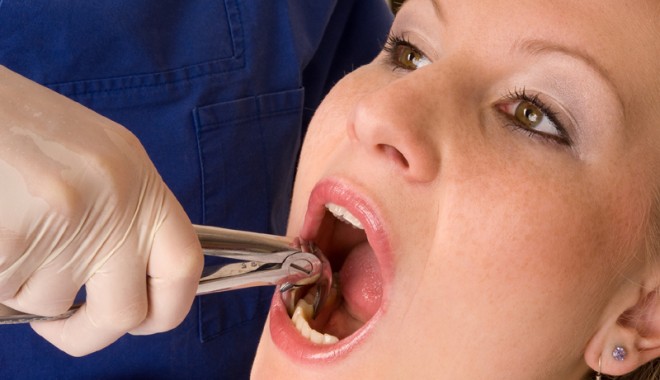 Boala gingivală și multiplele sale cauze. Află cum se tratează - boalagingivala-1358442899.jpg