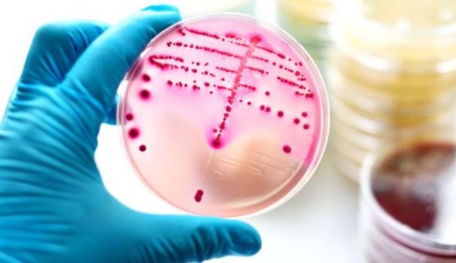 O superbacterie pentru care nu există tratament se răspândește tot mai mult ! - boalatratamentgonoree-1522929378.jpg