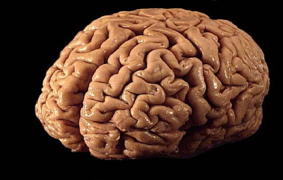 Săptămâna de conștientizare a creierului - brain-1331546783.jpg