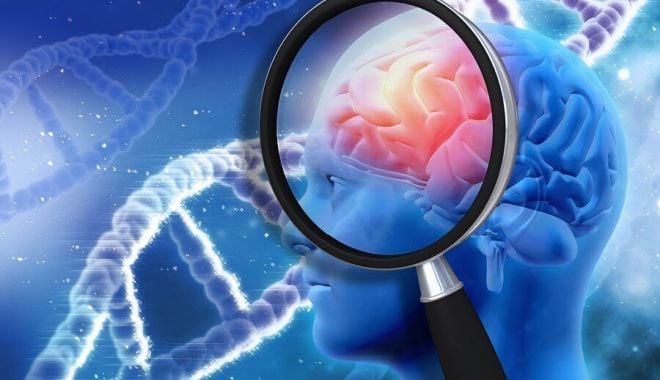 Efectele COVID-19 asupra creierului se confirmă, inclusiv în cazul formelor uşoare. Iată despre ce este vorba - brain26181-1646991398.jpg