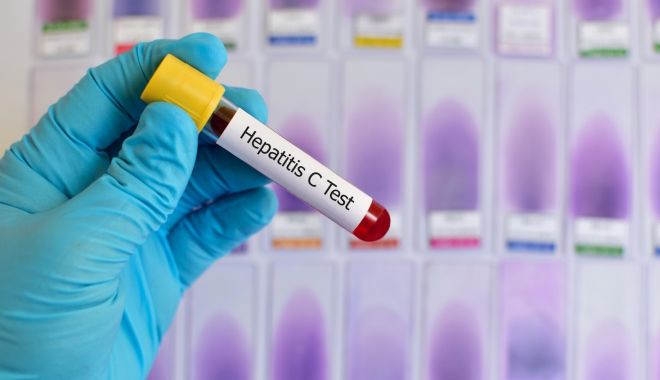 Campanie de testare gratuită pentru hepatita C - campanie-1620999884.jpg