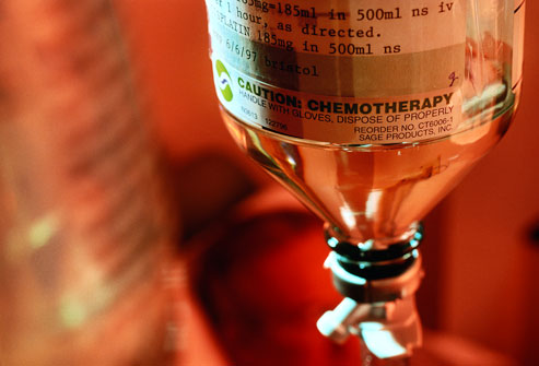Aveți rude cu cancer? Predispoziția către îmbolnăvire este mai mare - cancerchemotherapy-1374829781.jpg