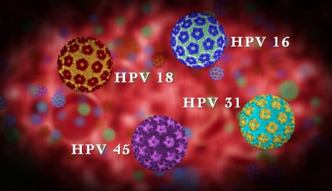 Factori de risc pentru cancerul de col uterin - cancercolhpv-1477924670.jpg