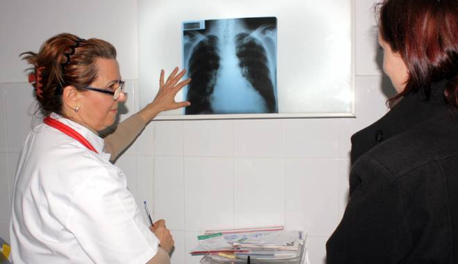 Ce boală pulmonară poate provoca decesul pacienților - ceboalapulmonaraveraenikopallpne-1425219672.jpg