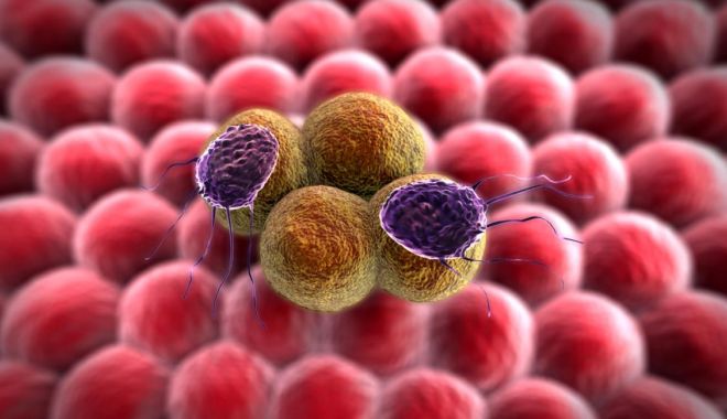 Celulele cancerului mamar au fost transformate, cu succes, în grăsime. Procesul oprește apariția metastazelor - celulecanceroase-1547716995.jpg