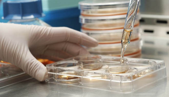 Existența celulelor stem canceroase, confirmată - celulestem-1344010113.jpg