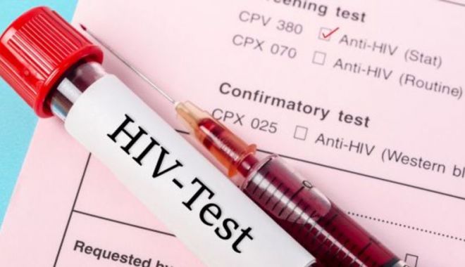 O echipă de cercetători a anunțat că este posibil să fi vindecat o femeie de HIV - cercetatorihiv-1645025660.jpg