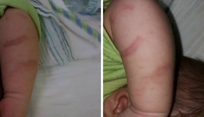 CAZ REVOLTĂTOR ÎN SECȚIA DE PEDIATRIE! Bebeluș 