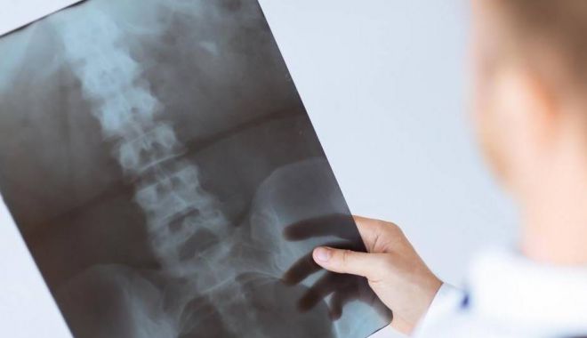 DESCOPERIRE IMPORTANTĂ! Coloana vertebrală este mai ''inteligentă'' decât se credea anterior - coloanaoperata-1551607685.jpg