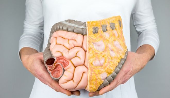 Cum se poate depista cel mai ușor cancerul de intestine - colonintestindurereabdominala-1525430727.jpg