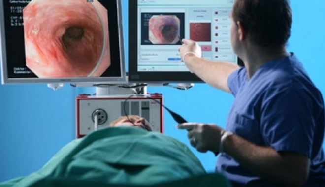 Cum depistam cancerul colorectal. Avantajele colonoscopiei - colonoscopie-1469958033.jpg