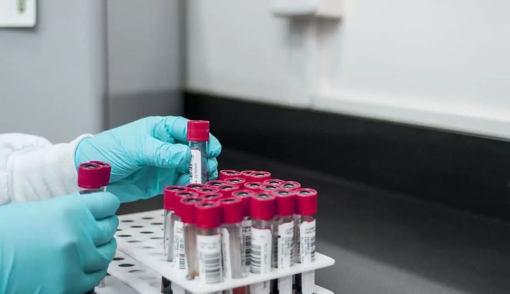 Când ar trebui să mergeți la un consult hematologic - consult-1760959898.jpg