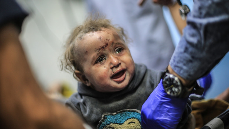 Copii răniți în Gaza vor fi aduși cu avioane militare la spitale din România