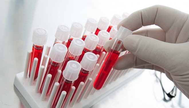 Copiii născuți  din părinți cu HIV, monitorizați la Constanța - copiiinascuti-1408377591.jpg