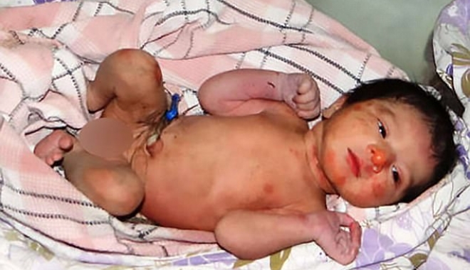 CAZ ȘOCANT! Fetiță abandonată într-un tufiș cu spini, pentru că nu s-a născut băiat - copilabandonat2-1502873053.jpg