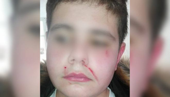 Elev bătut de mămici, la școala 