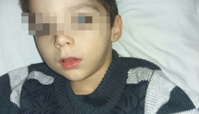 Apel umanitar. Haideți să salvăm un băiețel de patru ani! - copilbolnav-1515159222.jpg