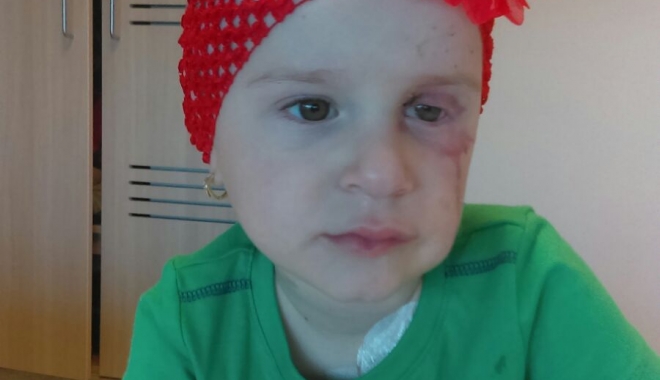 O fetiÈ›Äƒ de trei ani se luptÄƒ cu cancerul la ochi. HaideÈ›i s-o ajutÄƒm! - copilcancerochi-1513251662.jpg