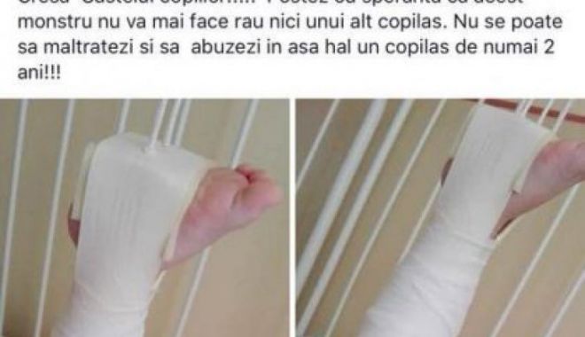 Fiica unui fost mare fotbalist, reținută pentru agresiune asupra unui copil - copilpiciorghipsroxanapetcu419x6-1530194194.jpg