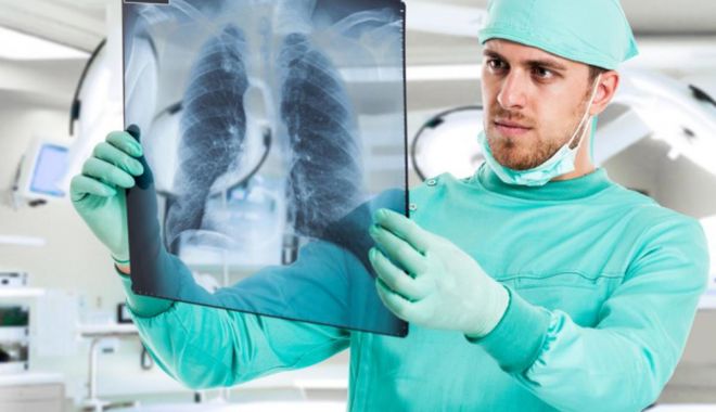 Ce afecțiune duce la complicații pulmonare - cordsursaunica-1641225090.jpg