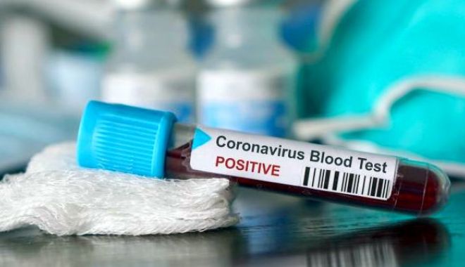 O nouă victimă a coronavirusului. S-a înregistrat decesul nr. 44 - corona-1585561140.jpg