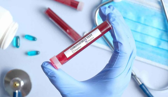 Creștere alarmantă a infecțiilor cu coronavirus, la Constanța. 20 de cazuri noi în 24 de ore - corona-1594375821.jpg