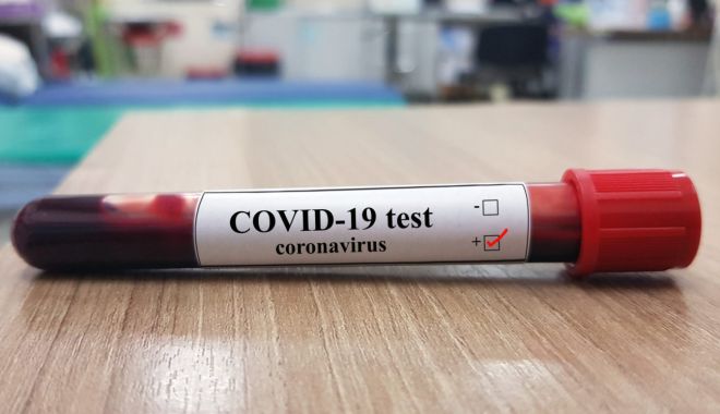 Încă un primar, depistat pozitiv cu coronavirus - corona-1594559617.jpg