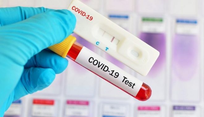 COVID-19. O nouă creștere a cazurilor noi, la peste 20.000 de teste efectuate în 24 de ore - corona-1598349664.jpg