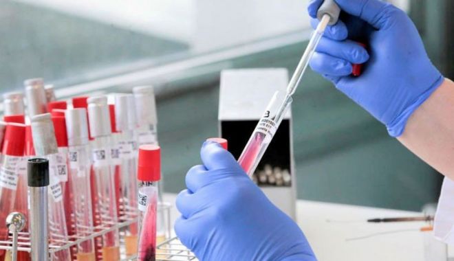 Numărul îmbolnăvirilor de coronavirus a crescut. 238 de cazuri confirmate în ultimele 24 de ore - corona1-1591265112.jpg