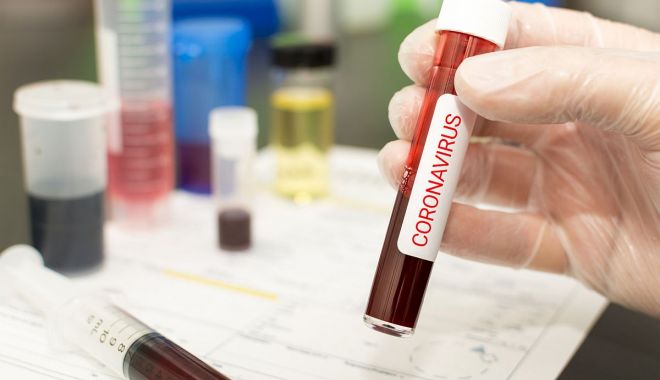 Coronavirus la Constanţa. 5.269 de persoane au fost confirmate cu COVID până în prezent - corona11-1603906770.jpg
