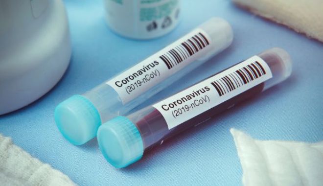 30 de cetățeni români confirmați în străinătate ca fiind infectați cu noul coronavirus - corona2-1584785145.jpg