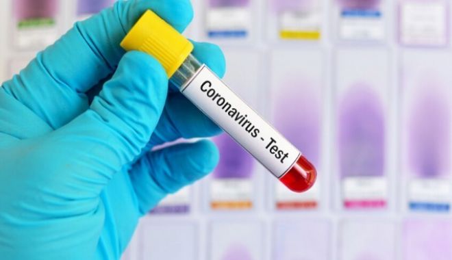 Peste un milion de teste au fost făcute în România de la începutul epidemiei - corona2-1595421223.jpg