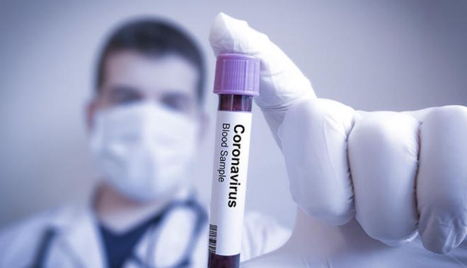 Focar de coronavirus la o fabrică de confecții: Cel puțin 23 de angajați au fost infectați - coronavirus-1596889131.jpg