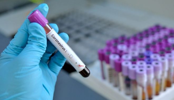 Teste pentru identificarea Covid-19 în șapte centre din țară - coronavirus2-1584364278.jpg