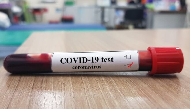 Noul coronavirus a ajuns la Primăria Constanța.  Doi angajați, confirmați pozitiv - coronavirus2-1592580442.jpg