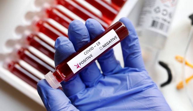 Coronavirus la Constanţa. Câte persoane au fost infectate cu COVID până în prezent - coronaviruspositive11200-1617122562.jpg